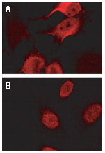 Immunofluorescence confocal microscopy of BAG-2 using ab47106 at 1:2000 on HeLa cells growing on coverslips left untreated (A) or heat shocked at 42 degrees for 30 min (B). Cells were fixed with 3.7% paraformaldehyde, permeabilized with 0.5% Triton X-100 prior to antibody staining. BAG2 localized to the cytoplasm of untreated cells, and to the nucleus of cells subjected to heat shock.