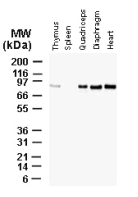 All lanes : Anti-Bag3 antibody (ab47124) at 1/2000 dilutionLane 1 : Thymus lysates, total protein (20ug/lane)Lane 2 : Spleen lysates, total protein (20ug/lane)Lane 3 : Skeletal(quadriceps) lysates, total protein (20ug/lane)Lane 4 : Skeletal(diaphragm) lysates, total protein (20ug/lane)Lane 5 : Smooth (heart) muscle lysates, total protein (20ug/lane)