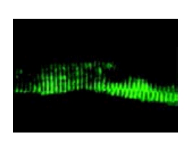 Frozen mouse muscle tissue section stained for BAG3 expression using ab47124 at 1/2000. The tissue section was fixed in 3.8% paraformaldehyde prior to staining. BAG3 localizes with Z-disk proteins."