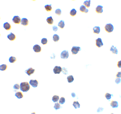 Immunocytochemistry of Bak in L1210 cells with ab62486 antibody at 2 µg/ml.
