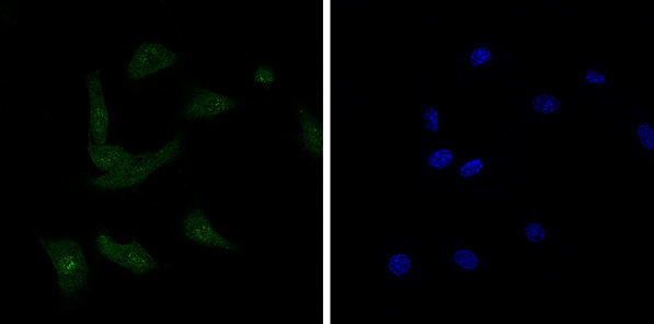 Immunofluorescent analysis of 4% paraformaldehyde-fixed, 0.1% Triton X-100 permeabilized HeLa (human cervix adenocarcinoma) cells labeling BANF1 with ab129184 at 1/100 dilution, followed by Goat anti-rabbit IgG (Alexa Fluor® 488) (ab150077) secondary antibody at 1/400 dilution (green). Confocal image showing mainly nuclear with weakly cytoplasmic staining on Hela cell line. The nuclear counterstain is DAPI (blue).