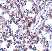 ab37120 at 2µg/ml staining BAP31 in rat lung tissue by IHC