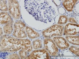 BBOX1 antibody (ab56350) used in immunohistochemistry at 3ug/ml on formalin fixed and paraffin embedded human kidney.