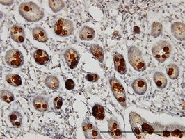 Abhd5 antibody (ab58275) used in immunohistochemistry at 3ug/ml on formalin fixed and paraffin embedded human small Intestine.