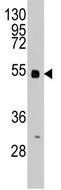 Anti-BBS4 antibody (ab71454) at 1/60 dilution + HeLa cell line lysate at 12.5 µgObserved band size : 50 kDa (why is the actual band size different from the predicted?)