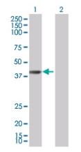 All lanes : Anti-BBS5 antibody (ab67162) at 1/500 dilutionLane 1 : Transfected 293T cell lysateLane 2 : non Transfected 293T cell lysateLysates/proteins at 25 µg per lane.SecondaryGoat Anti-Mouse IgG (H&L)-HRP Conjugate at 1/5000 dilution