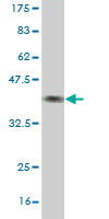 Western blot against tagged recombinant protein immunogen using ab55023 BBS7 antibody at 1ug/ml.
