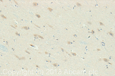 IHC image of ABHD6 staining in Human Hippocampus formalin fixed paraffin embedded tissue section, performed on a Leica Bond system using the standard protocol F. The section was pre-treated using heat mediated antigen retrieval with sodium citrate buffer (pH6, epitope retrieval solution 1) for 20 mins. The section was then incubated with ab87532, 5µg/ml, for 15 mins at room temperature and detected using an HRP conjugated compact polymer system. DAB was used as the chromogen. The section was then counterstained with haematoxylin and mounted with DPX.