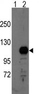 All lanes : Anti-BCAS3 antibody - C-terminal (ab70919) at 1/50 dilutionLane 1 : Nontransfected 293 cell line lysateLane 2 : 293 cell line lysate transiently transfected with the Breast carcinoma amplified sequence 3 geneLysates/proteins at 2 µg per lane.