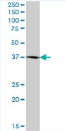 Anti-BCAT2 antibody (ab72850) at 1/500 dilution + human kidney lysate at 25 µgSecondaryGoat Anti-Mouse IgG (H&L)-HRP Conjugate at 1/2500 dilution