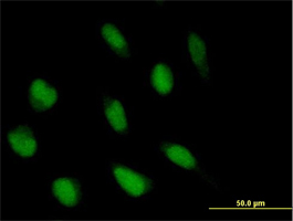 ab70144 at 10µg/ml staining ABl2 in Hela cells by Immunocytochemistry/Immunofluorescence.