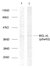 All lanes : Anti-Bcl-XL (phospho S62) antibody (ab30655) at 1 µg/mlLane 1 : Extracts from 293 cells treated with UV (5-30ug).Lane 2 : Extracts from MDA-MB-435 cells treated with UV (5-30ug).