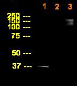 Lane 1 :  house keeping gene-ABV0P83XO at 1/500 dilutionLanes 2 - 3 :  Anti-ABI3BP antibody (ab68612) at 1/1000 dilutionLane 1 : 293T Lysate at 20 µlLane 2 : 293T Lysate at 10 µlLane 3 : overexpression lysate at 15 µlSecondaryGoat anti-mouse IgG-HRP at 1/5000 dilutiondeveloped using the ECL technique