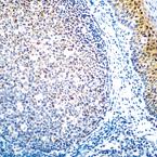 ab49470, at a dilution of 1/25, staining Bcl3 oncoprotein in paraffin sections of normal human tonsil by immunohistochemistry. Note nuclear staining of a proportion of follicular cells, parafollicular cells and mucosa.ab49470, at a dilution of 1/25, staining Bcl3 oncoprotein in paraffin sections of normal human tonsil by immunohistochemistry. Note nuclear staining of a proportion of follicular cells, parafollicular cells and mucosa.