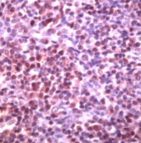 Ab41845 staining human Bcl6 in human tonsil by immunohistochemistry using formalin fixed, paraffin embedded tissue.