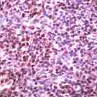 Ab41846 staining human Bcl6 in human tonsil by immunohistochemsitry using formalin fixed - paraffin embedded tissue.