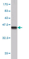 Western blot against tagged recombinant protein immunogen using ab56515 BCL7B antibody at 1ug/ml.