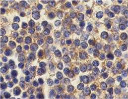 ab5972 at 10µg/ml staining BCMA in human spleen cells by IHC
