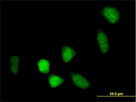 Immunofluorescence staining of BCOR in HeLa cells using ab88112 at 10 µg/ml followed by a fluorescein conjugated secondary antibody.