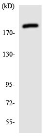 Anti-BCOR antibody (ab135975) at 1/500 dilution + HeLa cell lysate at 30 µg