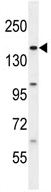 Anti-BCORL1 antibody (ab107412) at 1/100 dilution + HL60 cell lysate at 35 µg