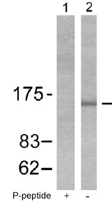 All lanes : Anti-Bcr (phospho Y177) antibody (ab51040) at 1/500 dilutionLane 1 : K562 cell extract, treated with the immunising peptide.Lane 2 : K562 cell extract, untreated.