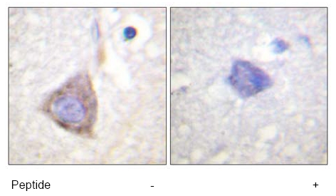 ab59352, at a 1/50-1/100 dilution, staining human Bcr in brain with (+) or without (-) immunising peptide, using Immunohistochemistry, Paraffin embedded tissue