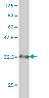 Western blot against tagged recombinant protein immunogen using ab54848 BDKRB2 antibody at 1ug/ml.