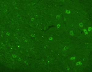 ab6201 BDNF antibody immunostaining in the ventral horn of the spinal cord. Protocol: free floating, PFA/picric acid perfusion fixed rat coronal sections (30 microns) were incubated overnight in ab6201 (1/500) followed by 1 night of postfixation). Immunofluorescence was visualised with TSA amplification. 