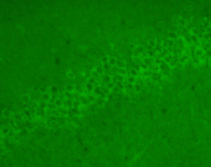ab6201 BDNF antibody immunostaining BDNF-containing hippocampal neurons. Protocol: PFA(only)-fixed free floating coronal rat brain sections (30 microns) were incubated for 3 days with ab6201 at 1/100 followed by direct immunofluorescence detection (alexa488; 1/1000). We recommend using an amplification IHC protocol following PFA/picric acid fixation of brain tissue for optimising BDNF detection using ab6201
