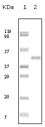 Anti-ABL2 antibody [1H1B11] (ab54209) at 1/200 dilution + truncated ABL2 recombinant protein