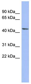 Anti-Bestrophin 3 antibody (ab94904) at 1 µg/ml (in 5% skim milk / PBS buffer) + Human fetal muscle lysate at 10 µgSecondaryHRP conjugated anti-Rabbit IgG at 1/50000 dilution