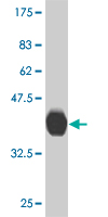 Anti-ABLIM1 antibody (ab55410) at 5 µg/ml + 0.2 µg/lane of partial recombinant ABLIM1 protein with a tagSecondaryGoat anti mouse IgG (H&L)-HRP conjugate at 1/5000 dilution