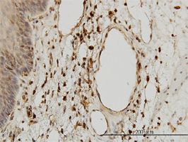 beta 2 Microglobulin antibody (ab54810) used in immunohistochemistry at 3ug/ml on formalin fixed and paraffin embedded human esophagus.