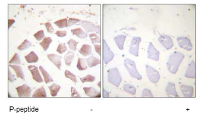 Immunohistochemistry analysis of paraffin-embedded human skeletal muscle tissue using ab59381 at a 1/50 dilution.Left image un-treated.Right image treated with phosphopeptide.