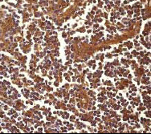 Ab32097, at a 1/500 dilution, staining beta Arrestin 1 in paraffin embedded human lymph node tissue by Immunohistochemistry.