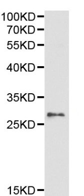 Anti-14-3-3 epsilon antibody (ab190742) at 1/500 dilution + extracts from A375 cells