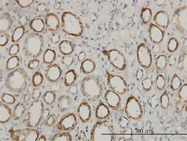 ACAA2 antibody (ab58278) used in immunohistochemistry at 3ug/ml on formalin fixed and paraffin embedded human kidney.