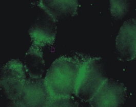 Untreated HEK293 cells incubated with the COPB ab6323 in a dilution of 1/100. This picture was kindly submitted as part of the review by Evelien Gellynck.