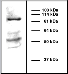 ab6323 at a 1/1000 dilution staining ~ 105 kDa beta COP in melanoma cell lysate by Western blot.  ab6323 at a 1/1000 dilution staining ~ 105 kDa beta COP in melanoma cell lysate by Western blot