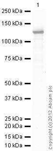 Anti-beta Galactosidase antibody (ab12081) at 1.5 µg/ml + Beta Galactosidase Recombinant at 0.1 µgSecondaryRabbit polyclonal to Goat IgG - H&L - Pre-Adsorbed (HRP) (ab65486) at 1/3000 dilutionPerformed under reducing conditions.