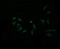 Immunofluorescent analysis of HeLa cells labeling ACAA2 with ab156957 at 1/100 dilution.