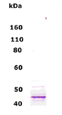Anti-beta III Tubulin antibody (ab66319) at 1/500 dilution + normal human brain lysate at 10 µg