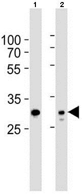 All lanes : Anti-14-3-3 epsilon antibody (ab199651) at 1/1000 dilutionLane 1 : 293T cell lysateLane 2 : HeLa cell line lysateLysates/proteins at 35 µg per lane.SecondaryGoat anti-rabbit IgG H&L(HRP) at 1/5000 dilution
