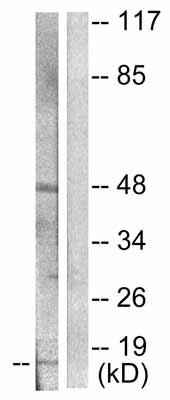 All lanes : Anti-beta Synuclein antibody (ab53167) at 1/500 dilutionLane 1 : HeLa cell extractLane 2 : HeLa cell extract with immunising peptide