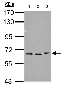 All lanes : Anti-beta TRCP2 antibody (ab154070) at 1/1000 dilutionLane 1 : NIH 3T3 whole cell lysateLane 2 : JC whole cell lysateLane 3 : BCL1 whole cell lysateLysates/proteins at 30 µg per lane.