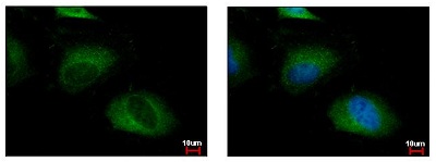 Immunofluorescent analysis of 4% paraformaldehyde-fixed HeLa cells (RT; 15 mins) labeling beta TRCP2 with ab154070 at 1/500 dilution. Right image shows cells co-stained with Hoechst 33342.