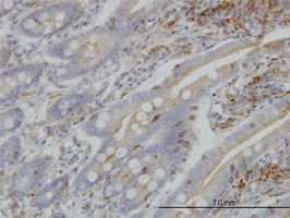 BFAR antibody (ab57347) used in immunohistochemistry at 3ug/ml on formalin fixed and paraffin embedded human small Intestine.