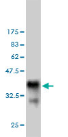 Western blot against tagged recombinant protein immunogen using ab57347 BFAR antibody at 1ug/ml.