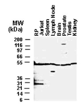 All lanes : Anti-BFAR antibody (ab47127) at 1/1000 dilutionLane 1 : BAR Recombinant protein (RP), 25 ug of total protein per lane.Lane 2 : Jurkat, 25 ug of total protein per lane.Lane 3 : Spleen, 25 ug of total protein per lane.Lane 4 : Lymph Node, 25 ug of total protein per lane.Lane 5 : Brain, 25 ug of total protein per lane.Lane 6 : Prostate, 25 ug of total protein per lane.Lane 7 : Testis, 25 ug of total protein per lane.Lane 8 : Kidney, 25 ug of total protein per lane.